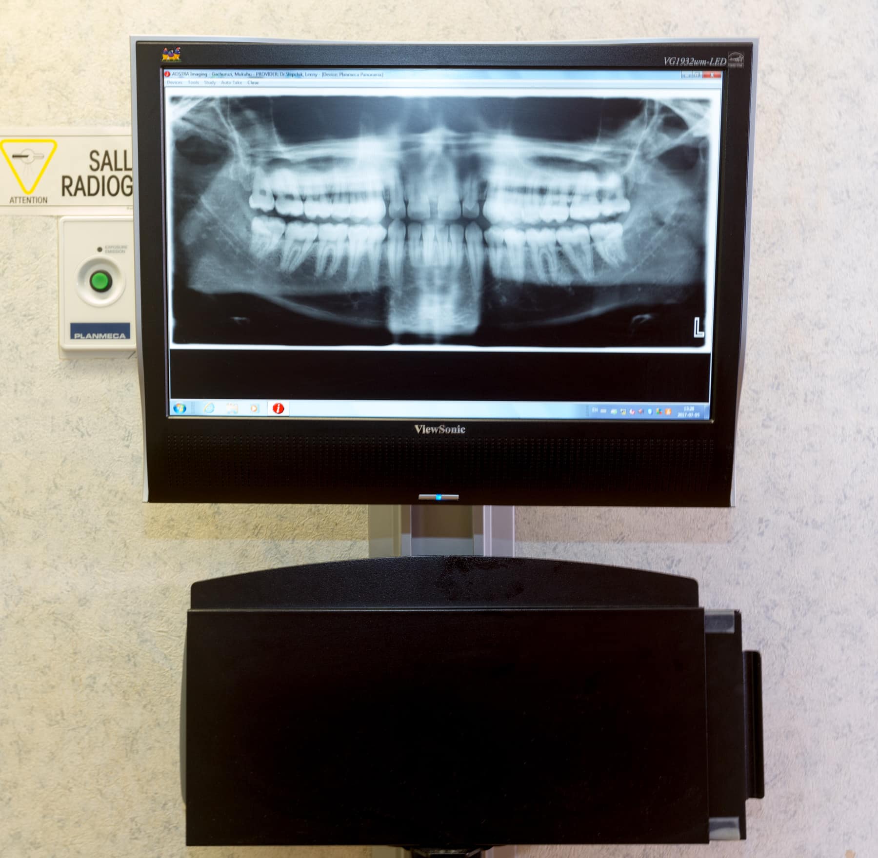 close up of x-ray of teeth on computer attached to wall with a button for the x ray machine on the left