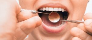 periodontal disease | Lenny Slepchik | Montreal, ON