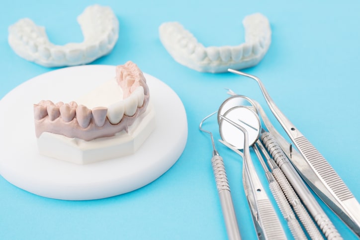 dental bridges | Montreal CA dental bridges | Montreal CA